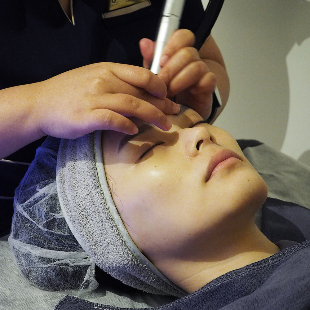 Doctor of Ozhean Zoey performing Hydrawhite Facial for Acne Extraction in Singapore