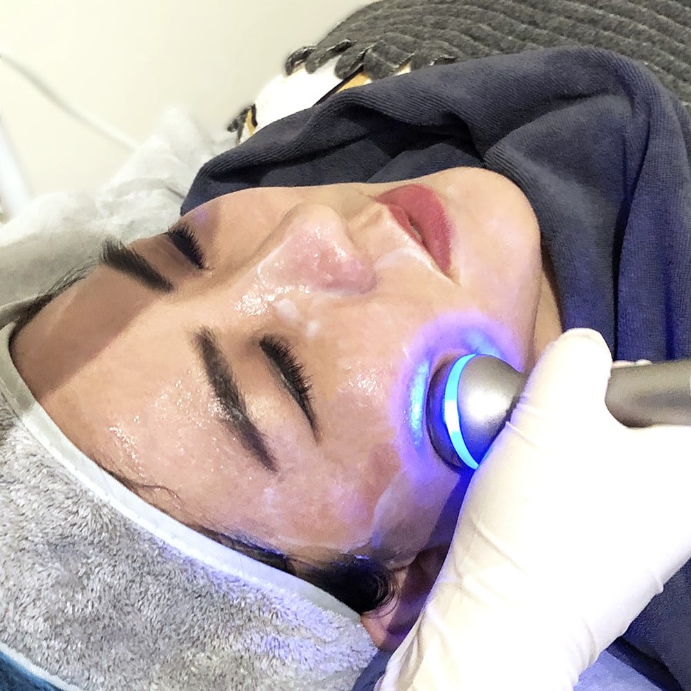 Ozhean Zoey | LDM Dual Frequency Ultrasound Treatment | Image for LDM Treatment Singapore
