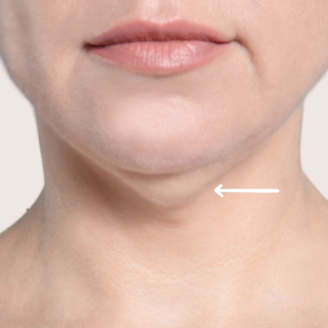 Double chin image - celluject