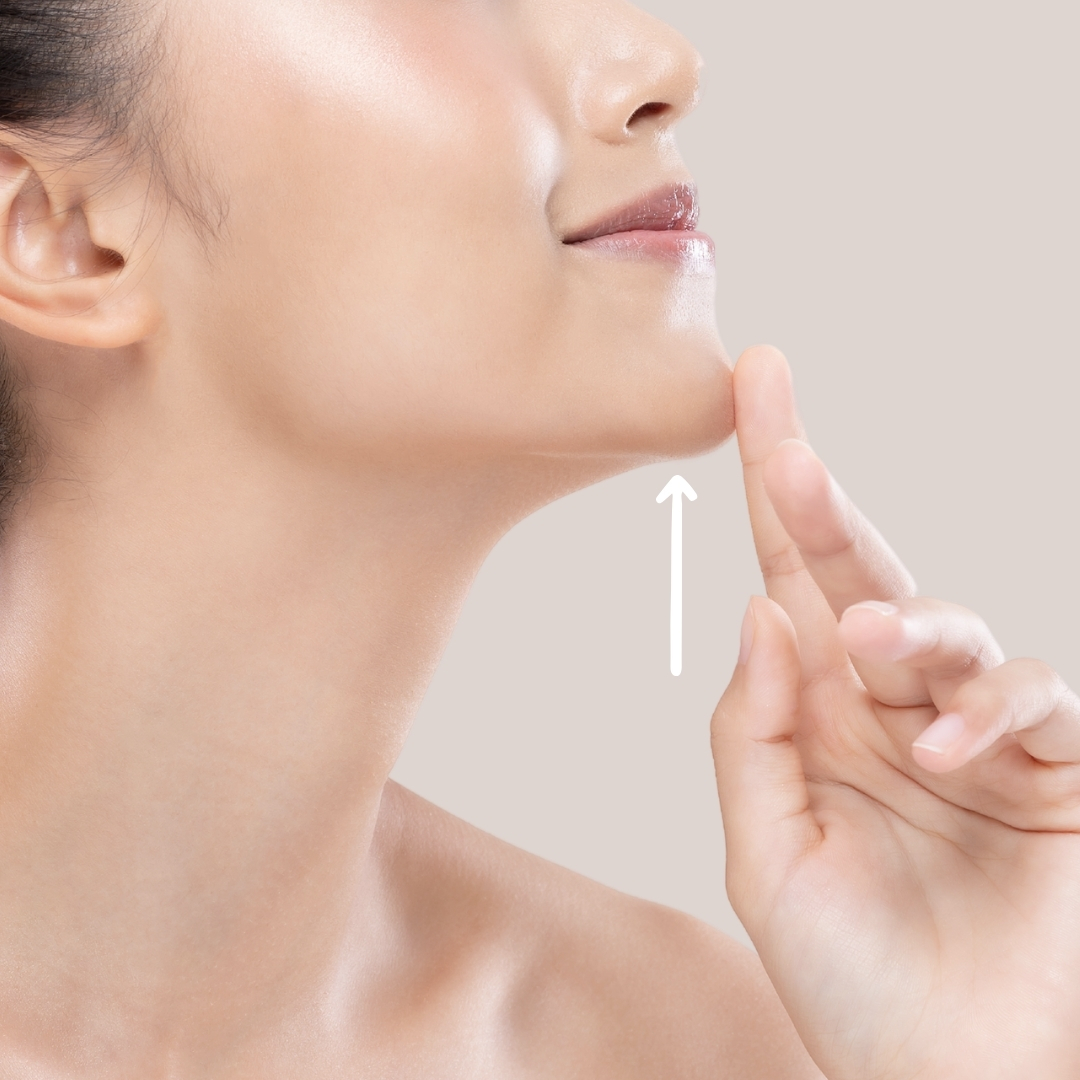 Double chin image - chin filler