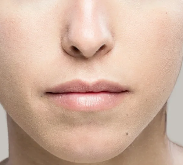 Crooked or Slightly Asymmetrical Nose