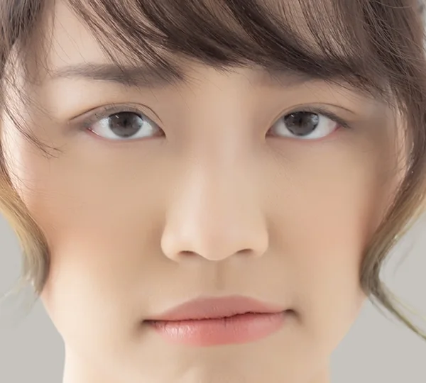 Lack of Nose Definition from Front or Side Profile