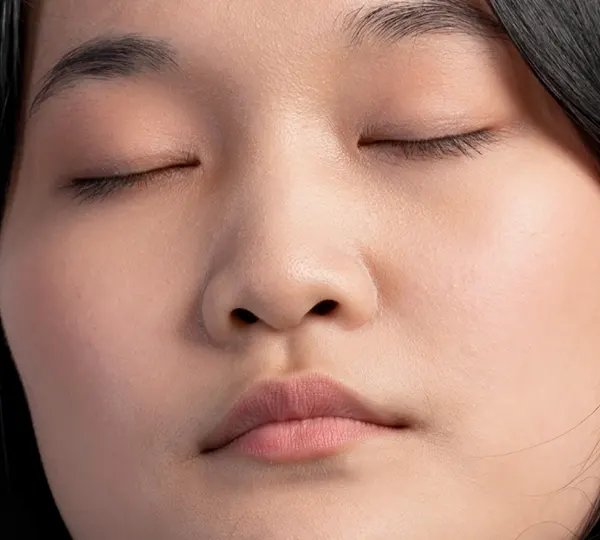 Low or Flat Nose Bridge