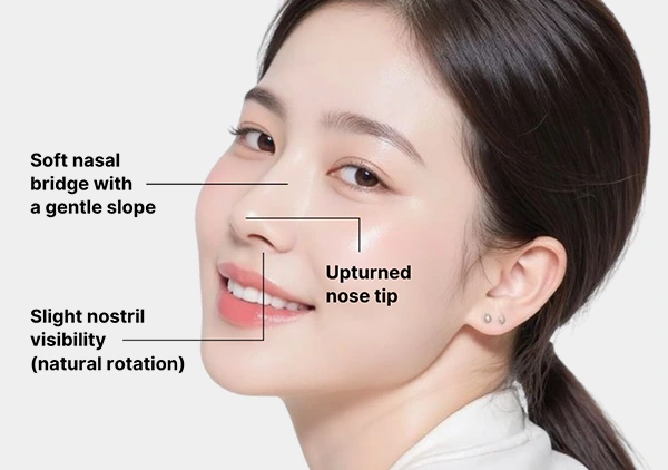 Nose Aesthetics for Women