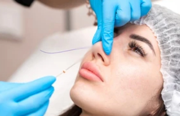 What Is Nose Thread Lift