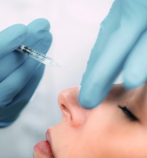 What is Nose Fillers