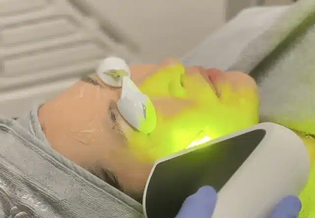 Yellow Laser