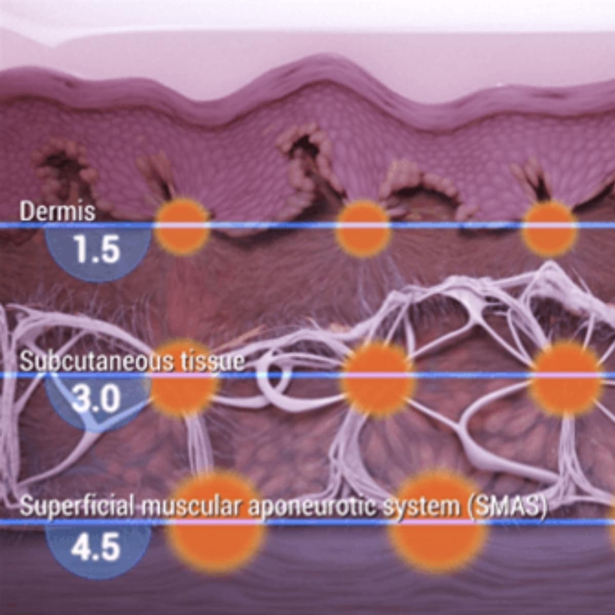 Gradual, Natural Results