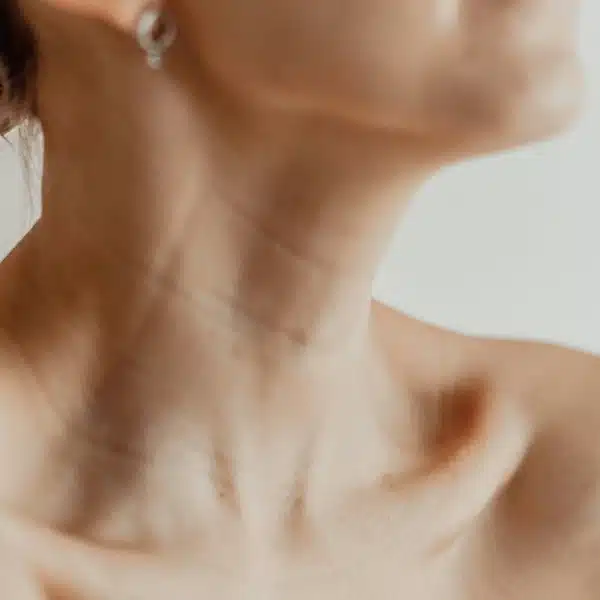 Neck Wrinkles & Sagging