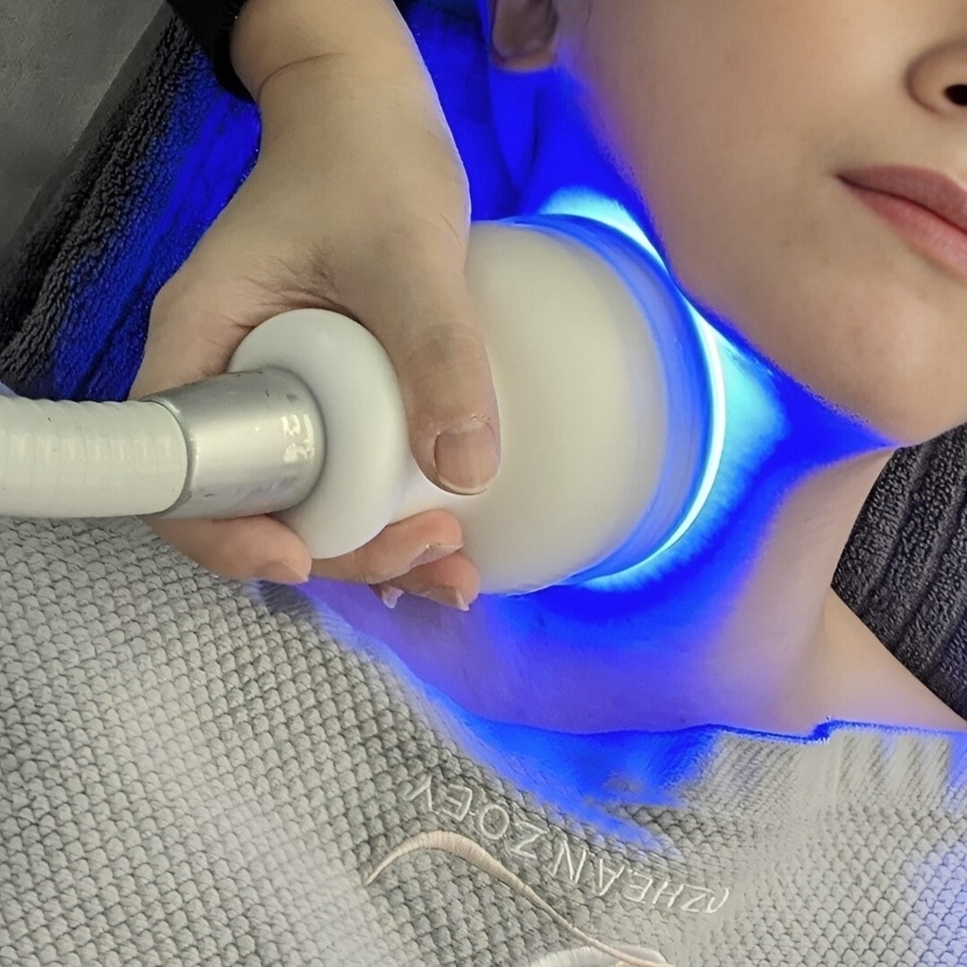CryoMax Fat Reduction