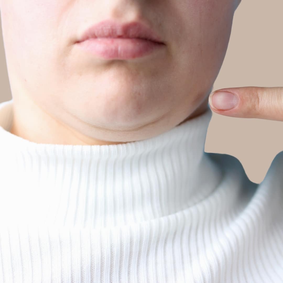 Double Chin Removal Singapore