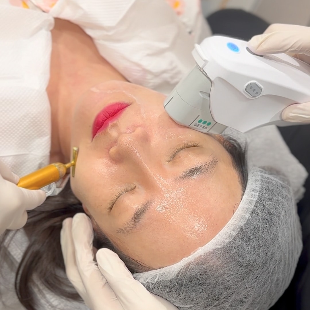 Ultherapy Prime (4.5mm Probe)