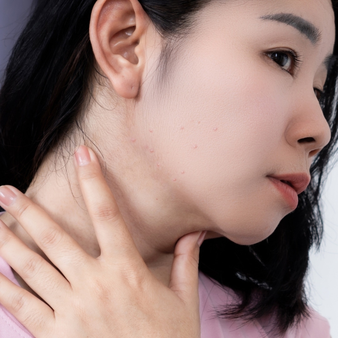 Lower Face & Jawline