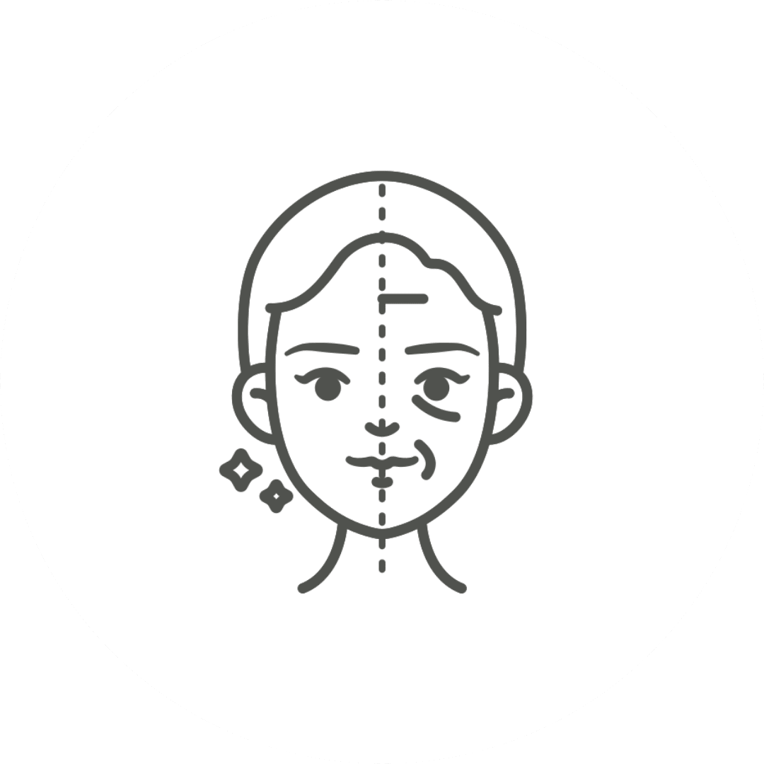 Reduction of Fine Lines & Crepiness